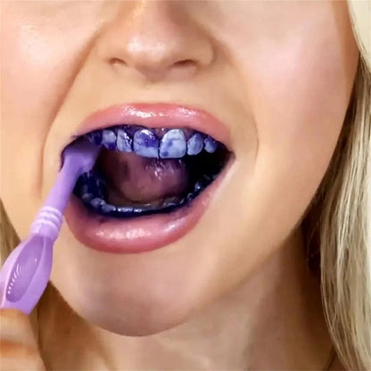Hismile Teeth Whitening v34